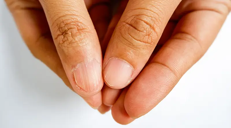 tekort aan mineralen symptomen