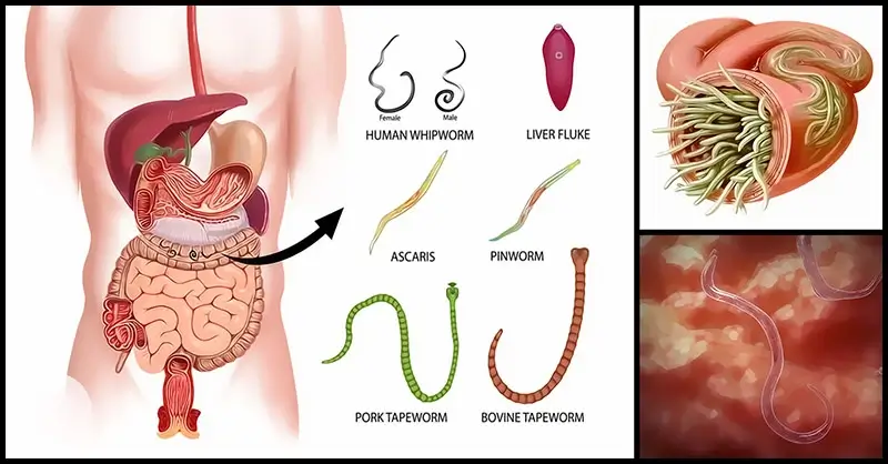 detox parasietenkuur